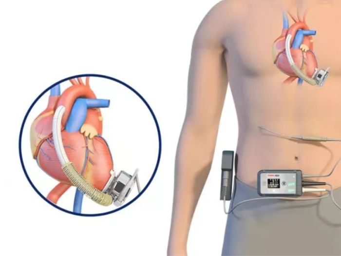 超声波热合机在医疗行业的应用
